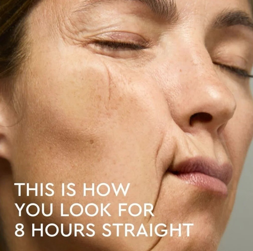 Close-up of a facial crease line that can form from sleeping against a pillow